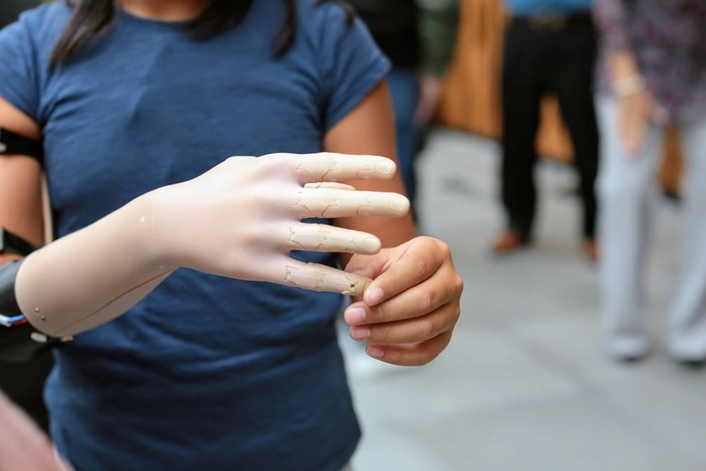 Featured image of Stratasys & Dassault Systèmes Partner to Develop Low-Cost 3D Printed Prosthetics