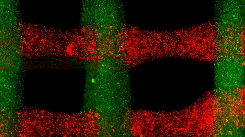 Featured image of Printable Body Tissue with Personalized Bio-Inks Boost Healing Potential