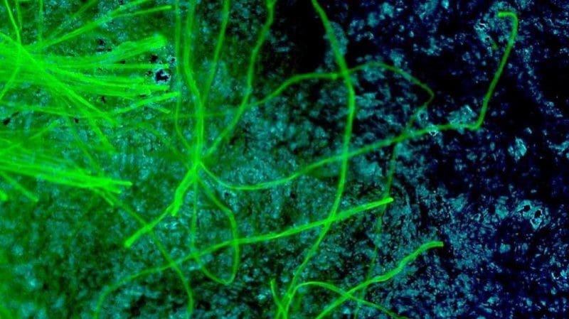 Featured image of DIY Fluorescence Microscope uses 3D Printed Parts and Smartphone Camera