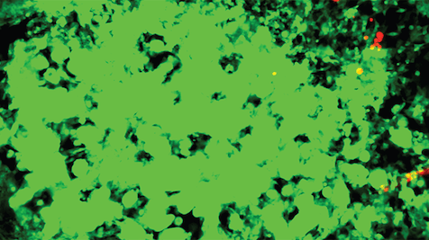 Featured image of Researchers 3D Bio-Print in Vitro Model to Study Cancer Drugs and Treatments