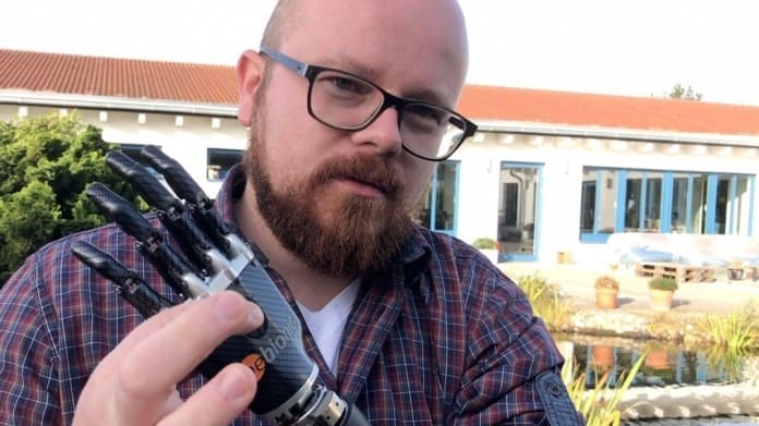 Featured image of This Man’s 3D Printed Bionic Arm is Thought-Controlled