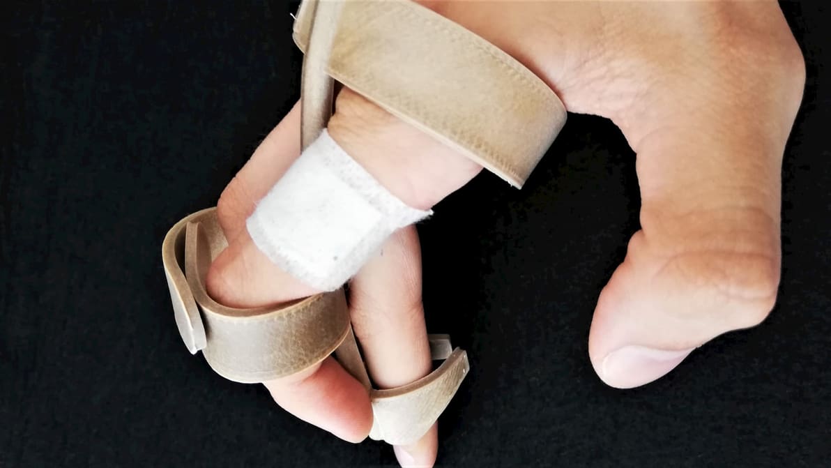 Featured image of 12 Great 3D Models That Can Help With Disabilities
