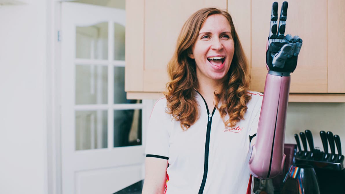 Featured image of The Most Common 3D Printed Prosthetics