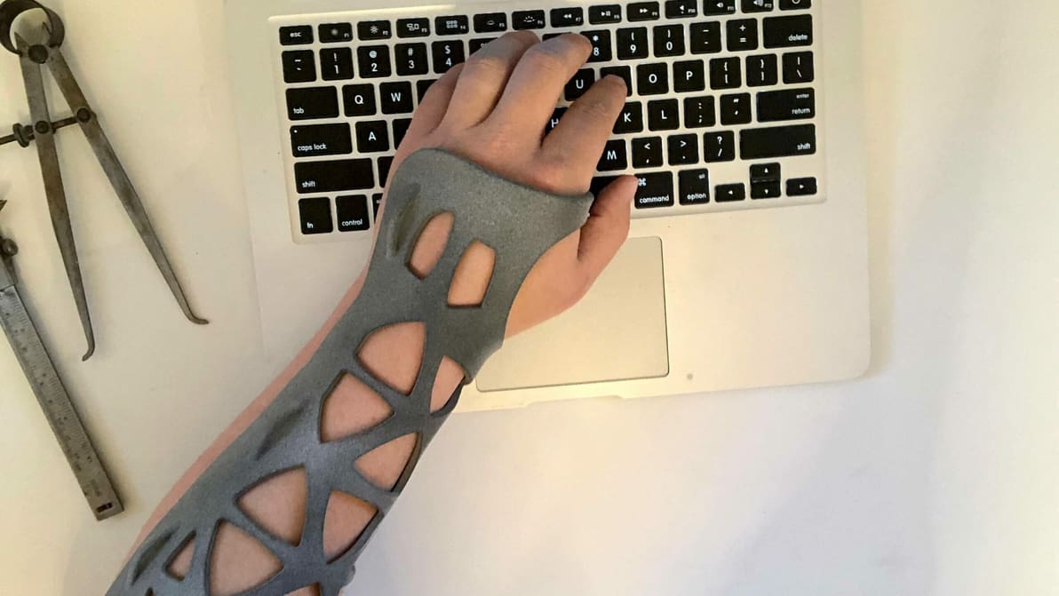 Featured image of Craftcloud Helps Cascade Orthotics Deliver Better Braces to Patients