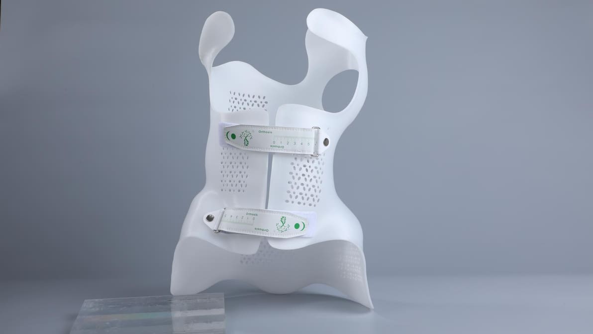 Featured image of 3D-Druck von Skoliose-Korsetts mit PioCreat: Eine klinische Komplettlösung