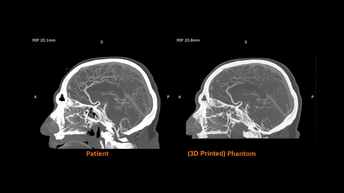 Image de l'en-tête de Stratasys développe un matériau 3D novateur qui imite le tissu humain lors d’examens médicaux