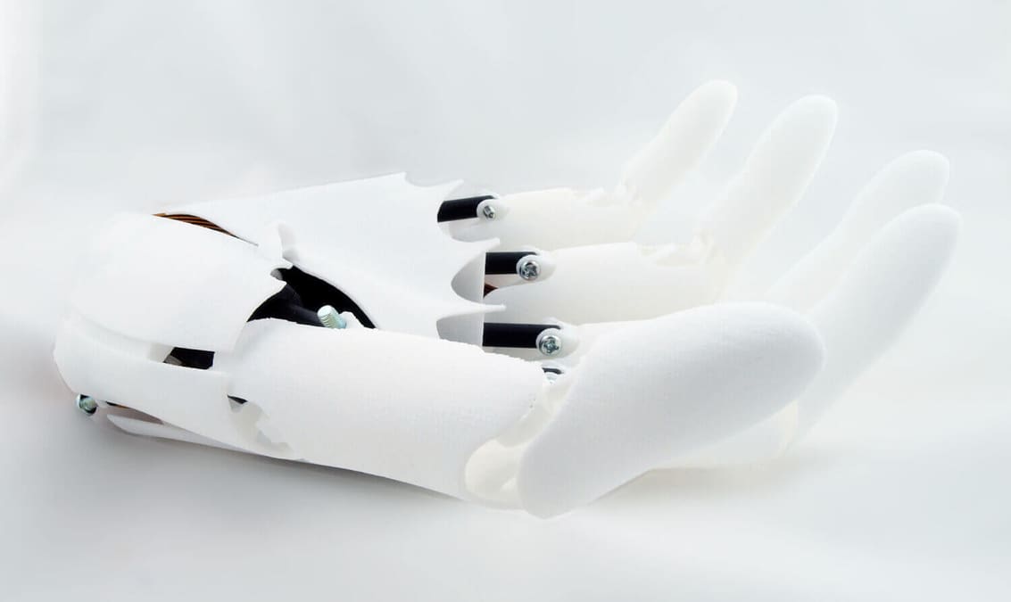 Featured image of 3D Printed Prosthetics made with Laser Sintering