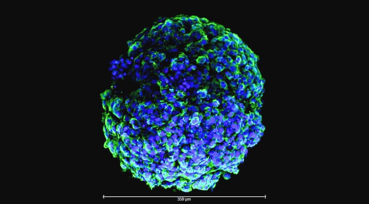 Featured image of 3D bioprinted body-on-a-chip project is “alive”