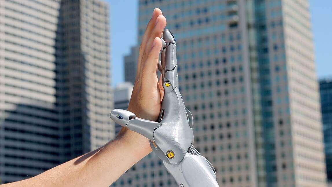 Featured image of 3D Printed Prosthetics: Cheaper, Better, More Versatile