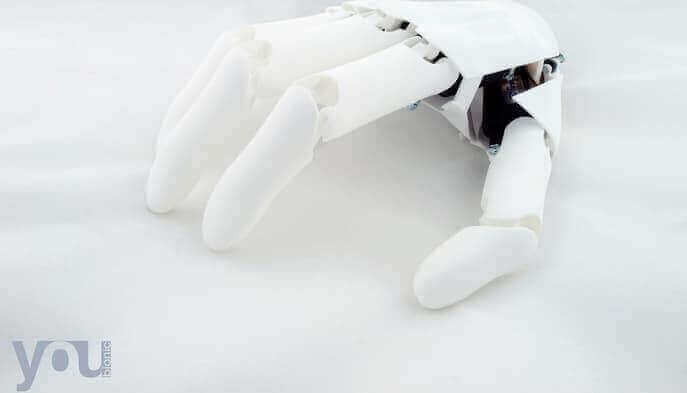 Featured image of New Youbionic Prosthetic Costs Only €1,200