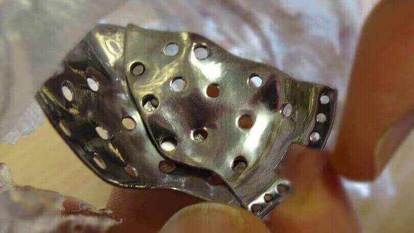 Featured image of Made in Wales: 3D Printed Implants For Facial Injuries