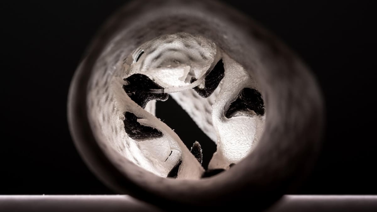 Featured image of 3D Printed Heart Valves Improve Surgery Success Rates