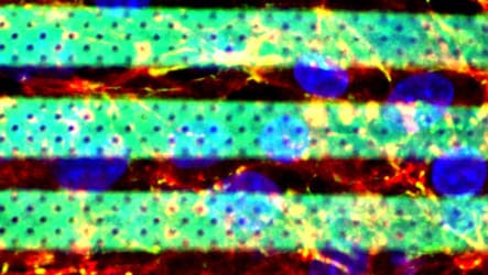 Featured image of Researchers 3D Print Accurate Microfluidic Model of the Blood-Brain Barrier
