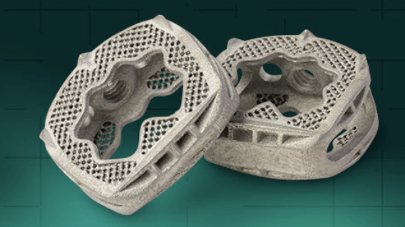 Featured image of Additive Implants’ 3D Printed SureMAX Cervical Spacer Cleared by FDA