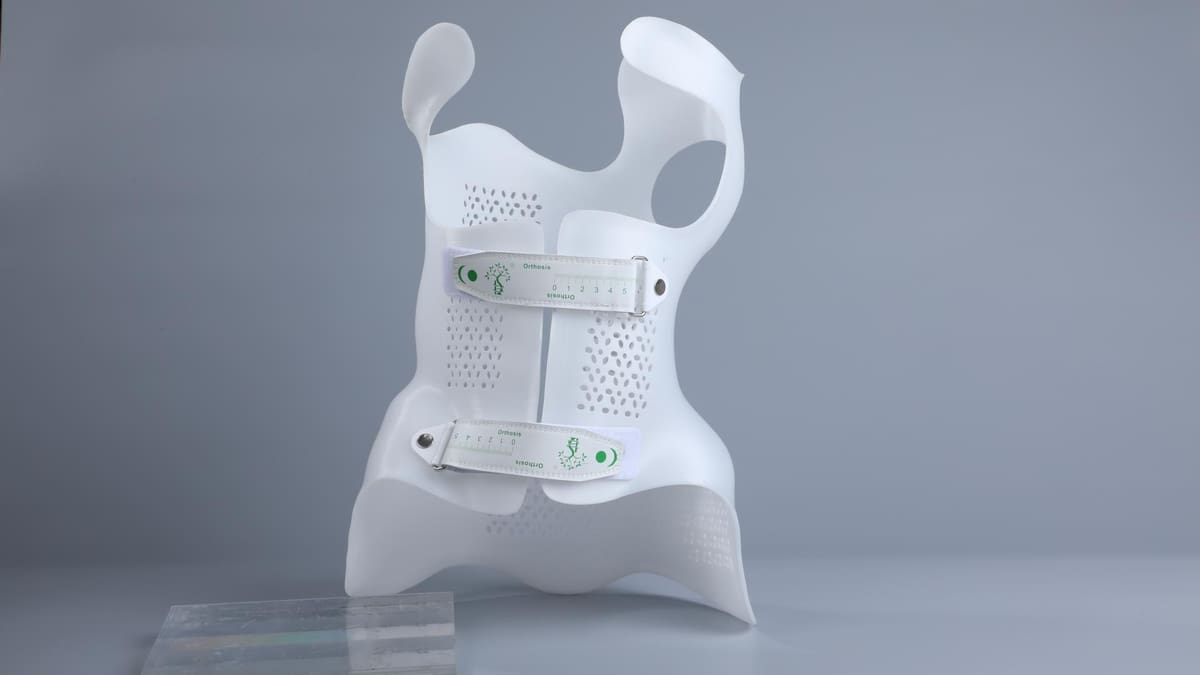 Featured image of 3D-Druck von Skoliose-Korsetts mit PioCreat: Eine klinische Komplettlösung