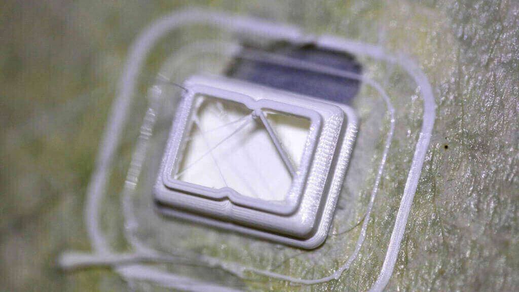Image of 3D Printing Troubleshooting: 3D Printing Problems & Solutions (FDM & SLA): Infill Looks Messy and Incomplete