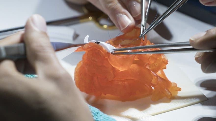 Image of 3D Printed Medical Models: Lifelike Materials for Medical Models