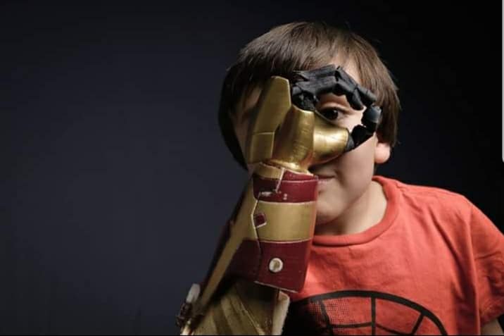3D printed prosthetics provide affordable alternatives.