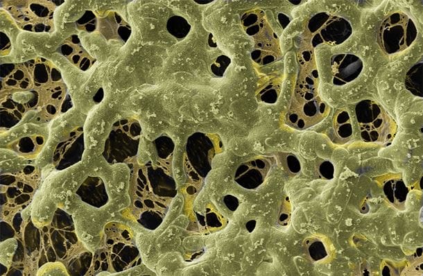 An alginate-based polymer network, demonstrating a porous structure through which cells and nutrients diffuse.
