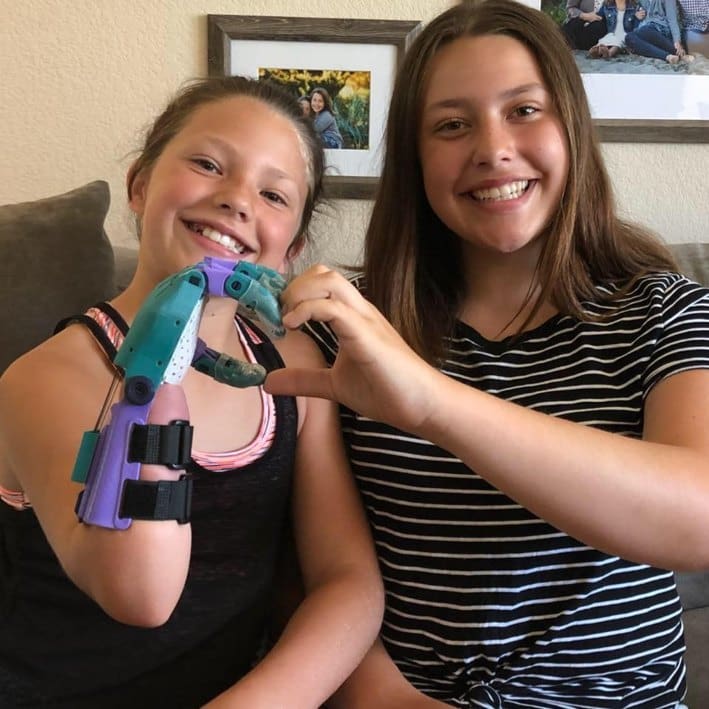 Abbey, a little girl gifted a 3D printed arm by the Million Waves Project.