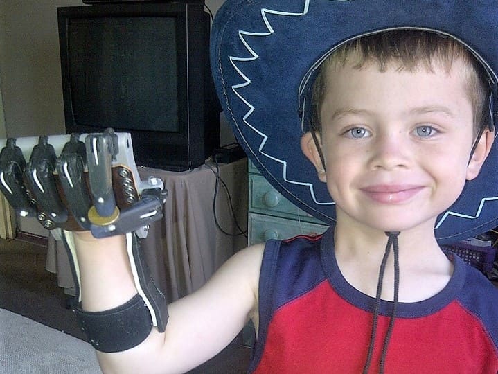 Liam with the prototype that paved the way for the open source e-Nable prosthetic.