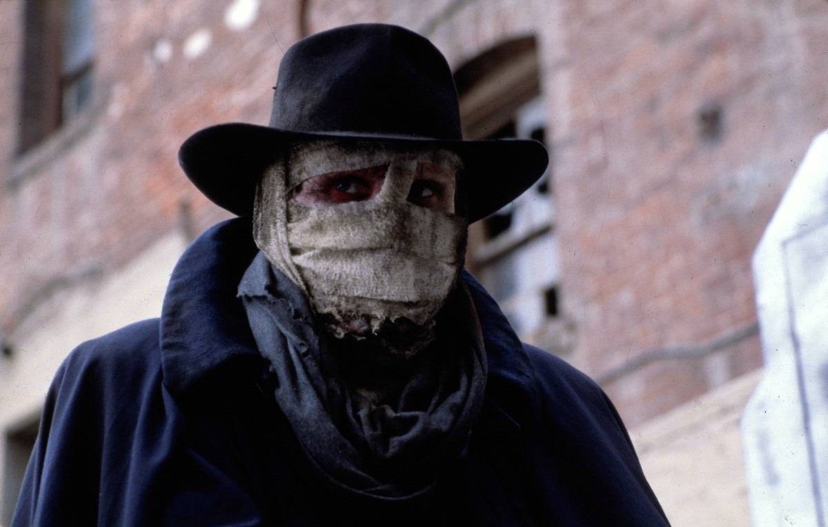 Liam Neeson's bandaged face.