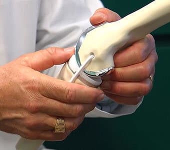 Virtual map of patient's knee