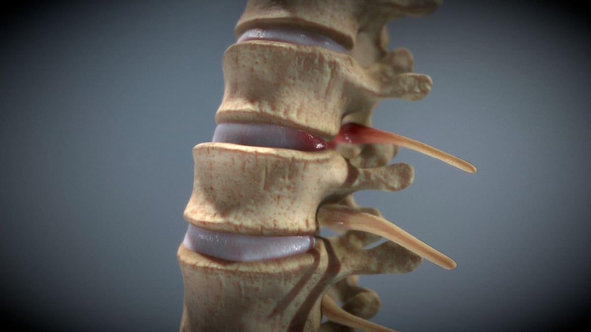 A model of a spinal injury.