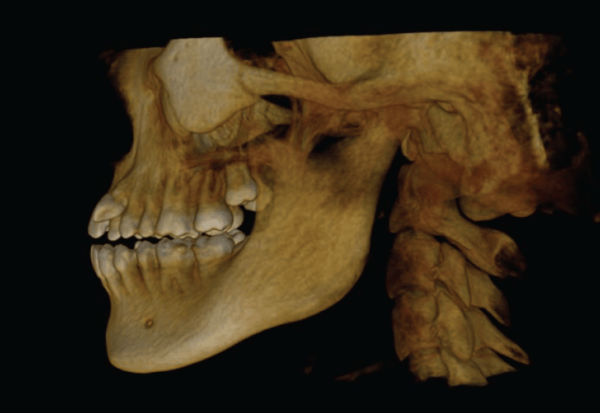 The amount of detail in this CBCT scan is impressive.