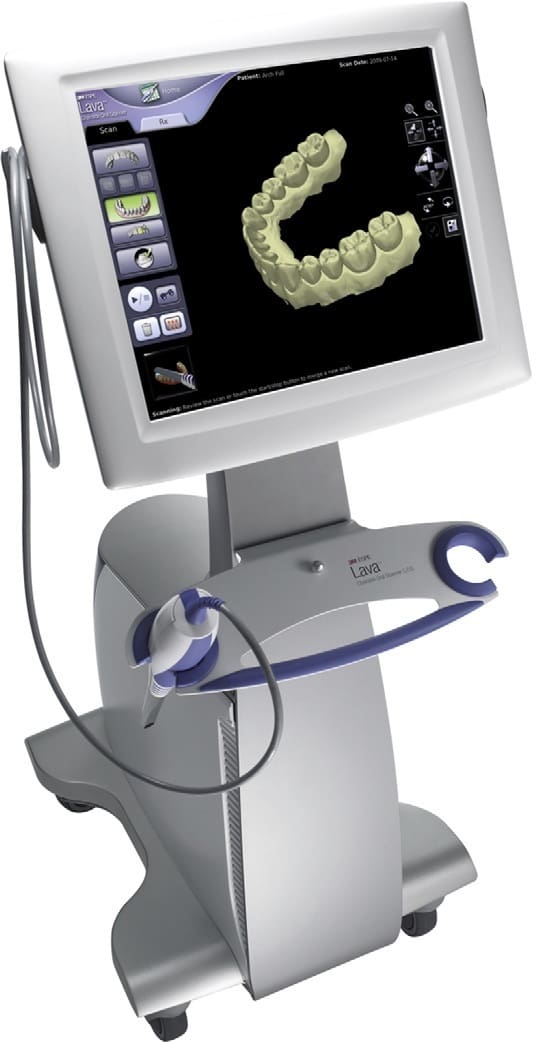 A chairside oral scanner.