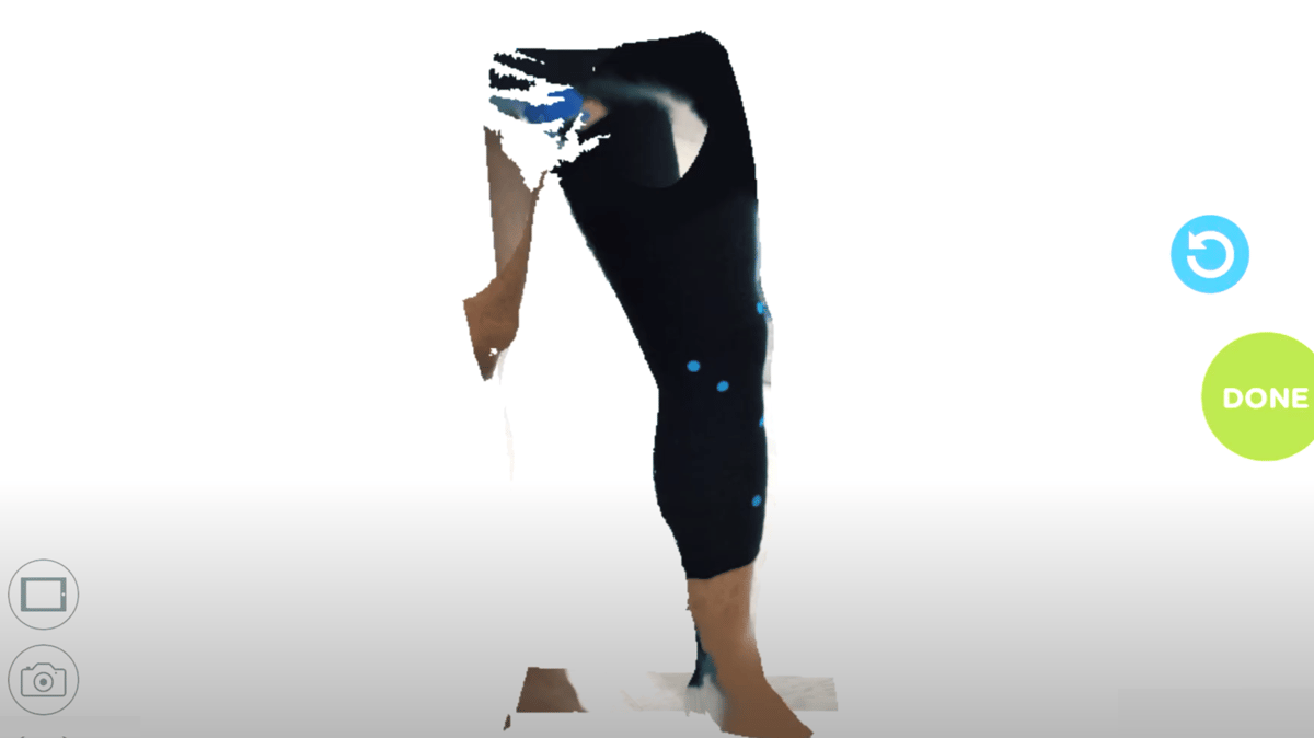 A scan of a patient's leg for the Evoke knee brace
