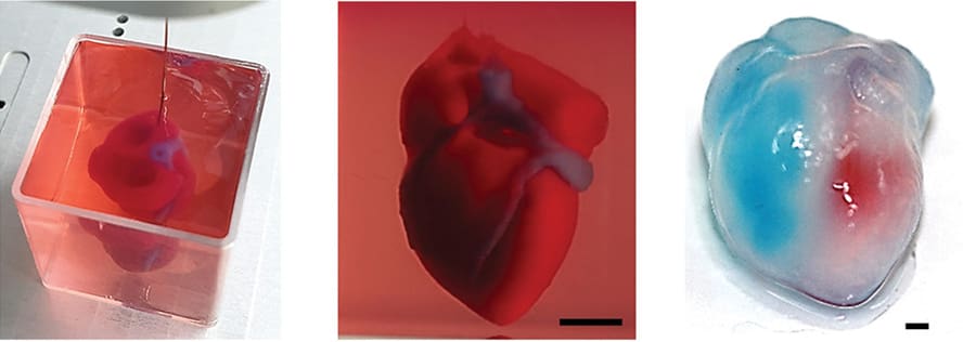 The first fully-vascularized 3D printed human heart