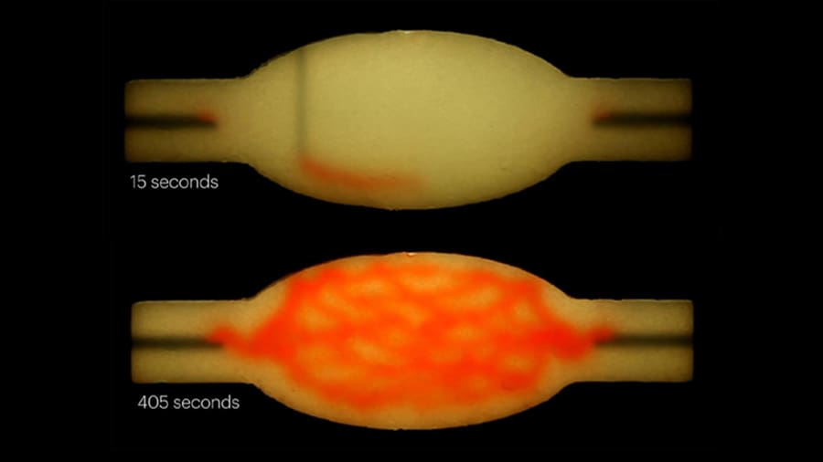 The 3D printed material is removed, leaving channels that allow blood to flow