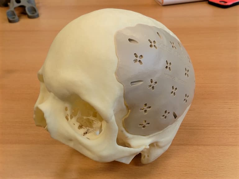 Image of: Project #1: Xilloc CT-Bone