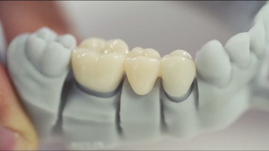 Homemade dentures are no longer a thing of the past