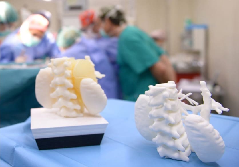 Image of Case Study: Medical 3D Printing: 3D Models Reduce Surgery Time