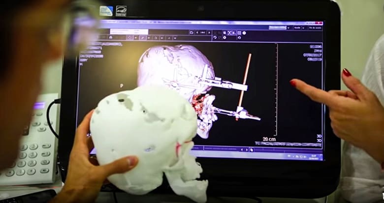 Image of Case Study: Medical 3D Printing: High Demand for In-Hospital 3D Printing