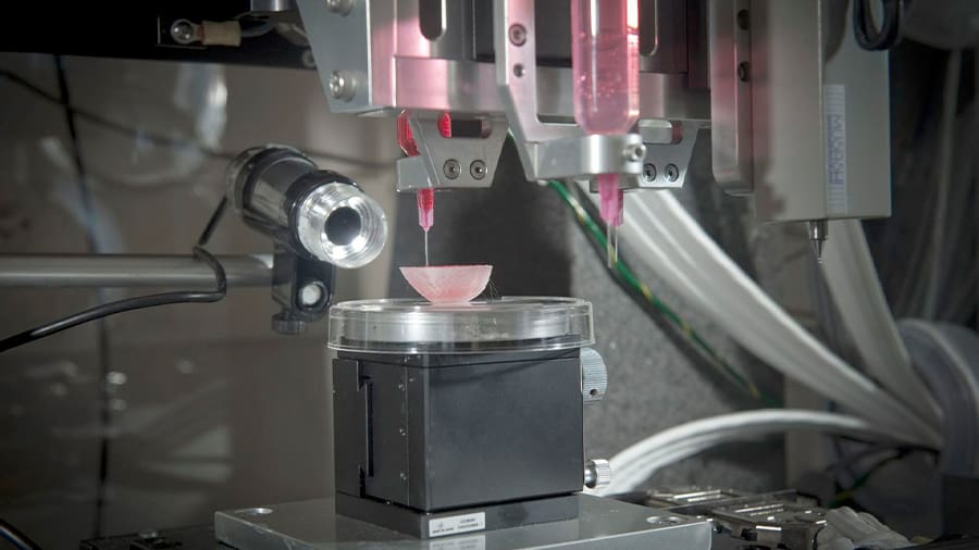 Kidneys, as the most needed transplant organs, are perfect bioprinting candidates