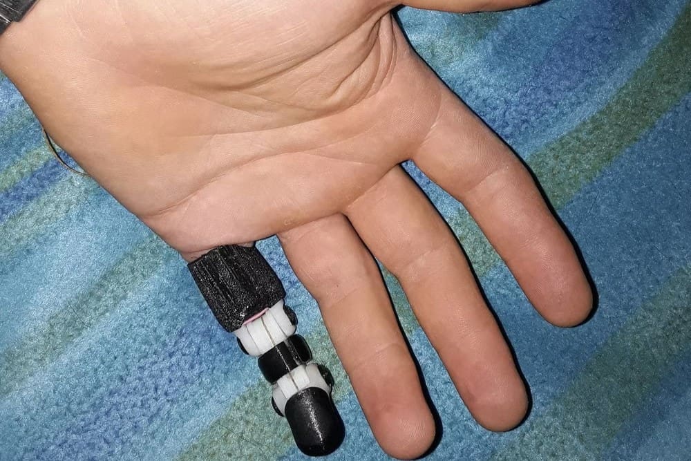 Image of: 12. Knick Finger