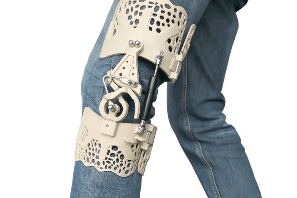 Image of: 13. Knee