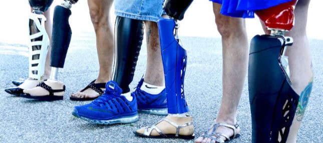 Unyq is a company that looks to make prosthetics personal and normalized