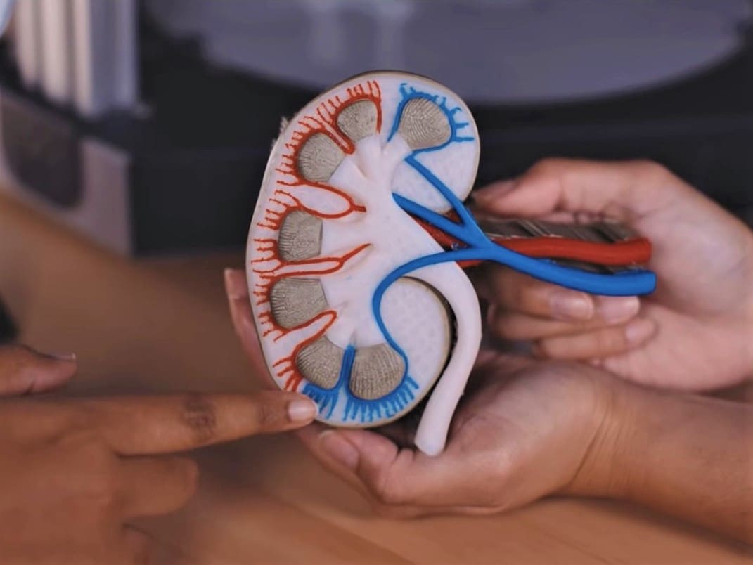 Model kidney
