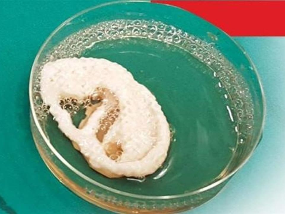 Once implanted, this scaffold will grow ear cartilage within a rabbit