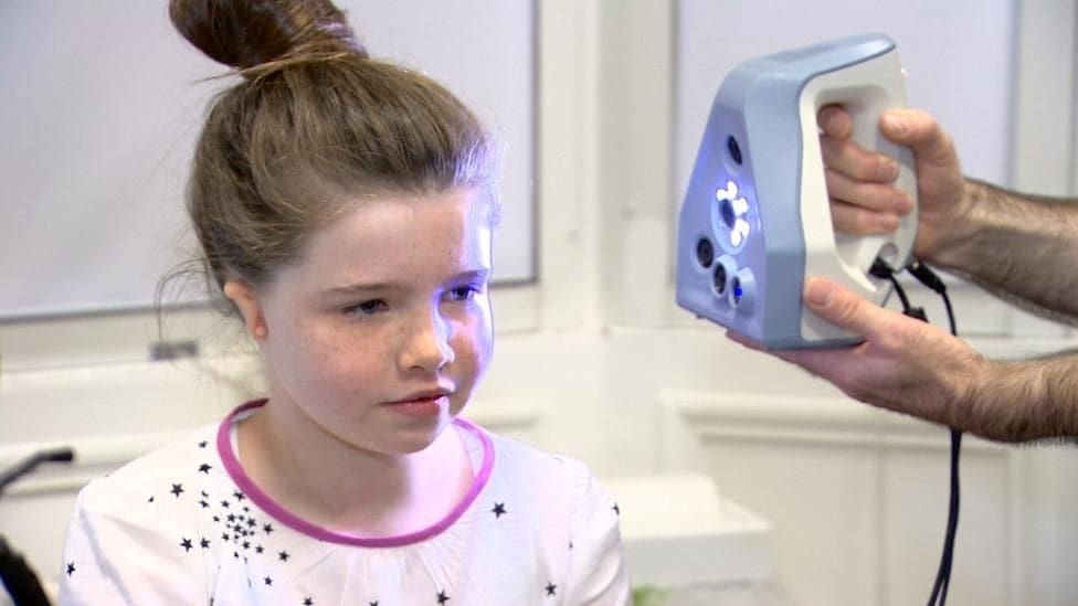 This patient is having her ear 3D scanned, so that a replacement for the other ear can be carved precisely