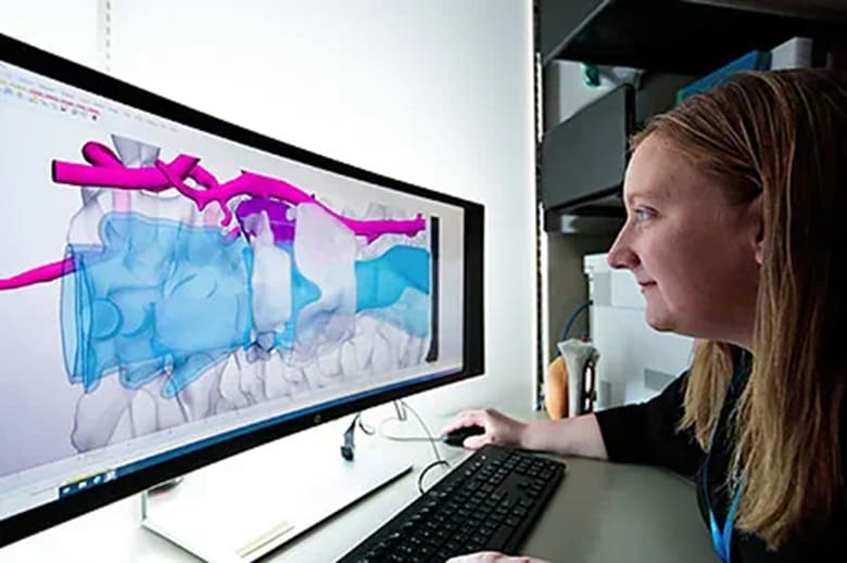 Image of 3D Printed Medical Models: Limitations of Medical Models