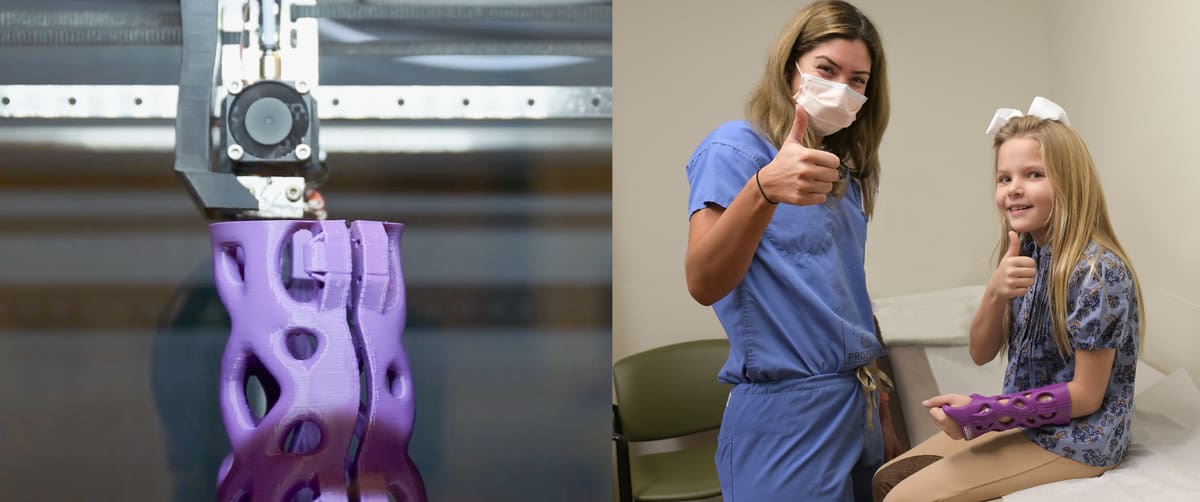 Image of 3D Print Orthotics, Braces & Casts: DIY Orthotic Braces