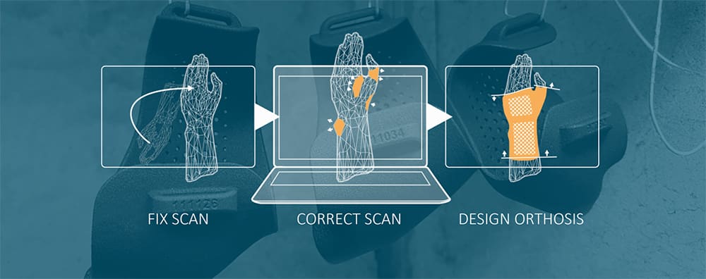 Image of 3D Print Orthotics, Braces & Casts: Artus3D