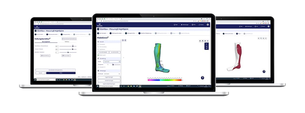 Image of 3D Print Orthotics, Braces & Casts: Mecuris
