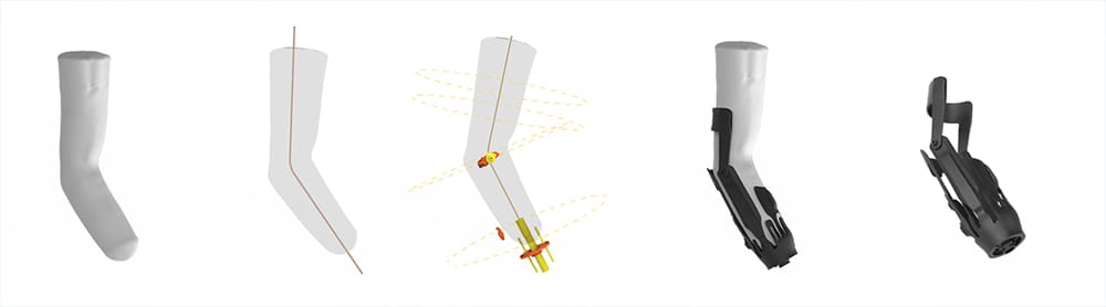 Image of 3D Print Orthotics, Braces & Casts: Toolkit 3D