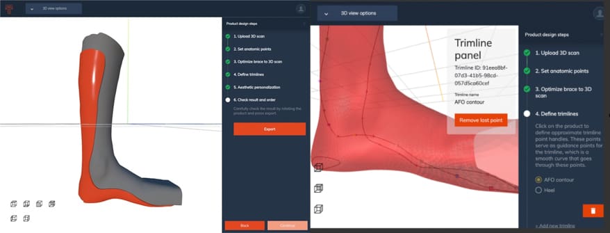 Image of 3D Print Orthotics, Braces & Casts: Twikit